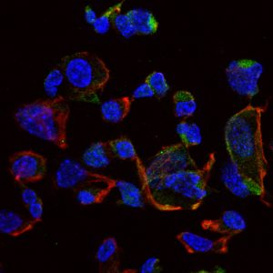 Imagem de microscopia, por imunofluorescência, de células dendríticas infectadas com o parasita Leishmania infantum