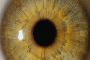  Exposição reúne um leque de imagens captadas no interior do olho humano.